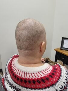 shaved head